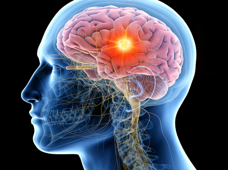 Wassili Zafiris. Is Depression a Disease? Depression Coaching. Happiness is Depressing.